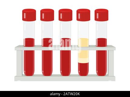 Cinque provette per analisi del sangue in rack, illustrazione del vettore medico Illustrazione Vettoriale