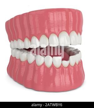3d rappresentazione della mandibola aperta con incisivo rotto dente inferiore su sfondo bianco Foto Stock