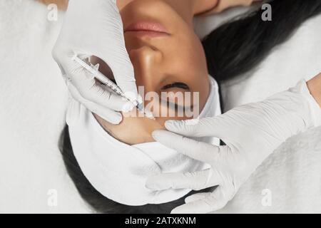 Vista dall'alto dell'iniezione di ialuronico nella fronte femminile. Il cosmetologo usa una siringa con riempitivo mentre il paziente brunette ha gli occhi chiusi, in un asciugamano sulla testa sdraiata. Concetto di cosmetologia, bellezza. Foto Stock