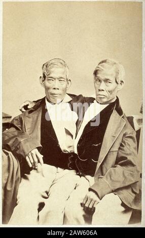 1865 ca , USA : I celebri GEMELLI SIAMESI Chang e Eng BUNKER (1811 - 1874) nati thailandesi-americani. Nato vicino a Bangkok, nel 1829 Robert Hun Foto Stock