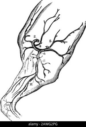 Il cavallo americano riformato libro, un trattato sulle cause, i sintomi e la cura di tutte le malattie del cavallo, compreso ogni malattia peculiare all'America, anche l'allevamento, e la gestione. D sera. Alcuni casi, tuttavia, sono incurabili, a causa dell'organicopatia dei bronchi, o della rottura di cellule d'aria nei polmoni. I Suchcases sono conosciuti dalla respirazione innaturale quando il cavallo isdrawing un carico pesante o che viaggia su collina. La sua respirazione è molto doloroso, e non solo porta in gioco i muscoli addominali, ma anche i muscoli del petto (intercostali). Valigetta Foto Stock