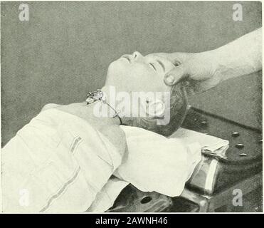 Terapia chirurgica e tecnica operativa . y^-- Fig. 366.-Tracheotomia ix il primo e secondo stadio infantile. Fig. 367.-Tp.acheotomia nel neonato.l'operazione è stato multato. Uno stoppino di garza è fissato sotto la cannula della tlie. 228 TERAPIE CHIRURGICHE E TECNICA OPERATIVA Foto Stock