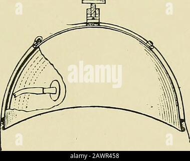 Ostetricia operativa : una guida alle difficoltà e alle complicazioni della pratica midwiferica . Fig. L-Schatzs Tokodynamomete PRECIPITA IL LAVORO 7 la quantità di forza necessaria per estrarre il bambino. Non è tuttavia necessario discutere i risultati ottenuti con tali metodi, poiché è evidente che non si potrebbe ottenere alcuna esattezza con dispositivi appropriati. Lo strumento più antico e più scientificamente costruito per calcolare la forza uterina è il tosobdinamometro di Schatz (Fig. 1), descritto circa quaranta anni fa.1 per mezzo di esso, e itsodifications, molte osservazioni interessanti e rintracciamento Foto Stock