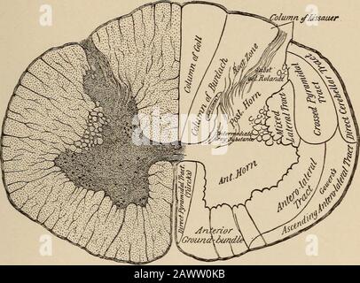 Malattie nervose e mentali. E hanno ancora una divisione dei tratti. Questi sono mostrati NELLA LOCALIZZAZIONE. 339 figura 125 per le degenerazioni ascendenti che seguono la completa divisione del cordone, e per le degenerazioni discendenti dopo lesioni simili. La sezione trasversale a forma di H della materia grigia mostra numerosi corpi cellulari. Di questi i gruppi anteriori di tutolo sono i migliori underscarowand contengono i corpi-cellule del neurone del motore inferiore attraverso whichmotor, trofiche, e influenze vasomotorie sono esercitate sui muscoli, sulle ossa e sulla pelle. Il canale centrale si trova nel grigio di commissu Foto Stock