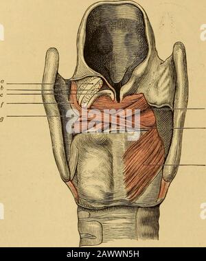 Vorlesungen über die Krankheiten des Kehlkopfes . sichnicht am SantorinischenKnorpel, sondern streicheunterbrochen, von derBasis des einen Aryknor-pels Kommend, den ande übersetzend, zur Seiteder Epiglottis der entge-gengesetzten Körperhälftehin. Er führt den Namenmusc. Costrittor vestiboli laryngis und ein Zweck ist der,durch Herabziehen der Epiglottis und Einrollen ihrer Seitenränder,durch Aneinanderdrängen der ary-epiglottischen Falten, mit Einwärts-neigung der Santorinischen Knorpel, den Eingang des Kehlkopfes zuverengen, Unscher, Unschen während Foto Stock
