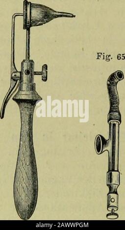 Elektrodiagnostik und Elektrotherapie einschliesslich der physikalischen Propädeutik für praktische Ärzte . iegsamen Mundhöhlenelektrodeverbunden 218 - isolirten Metallstab mit der Polklemme nach Art der   ist. Die Ohrelektrode (Fig. 64) besteht aus einem Elektrodengriffemit Polklemme, der an kurzem Verbindungsstabe einen federnden Ring zurFixation eines entsprechenden Hartgummi-Ohrtrichters und einen mit Polklemme in leitender Verbindung stehenden, winkelig abgebogenen, kinden, kaufen, kindern, kaufen, kaufen. Foto Stock