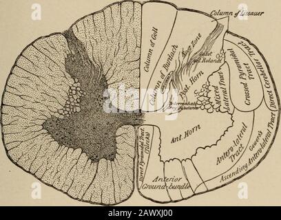 Malattie nervose e mentali . , abbiamo ancora una divisione dei tratti. Questi sono mostrati NELLA LOCALIZZAZIONE. 333 figura 125 per le degenerazioni ascendenti che seguono la completa divisione del cordone, e per le degenerazioni discendenti dopo lesioni simili. La sezione trasversale a forma di H della materia grigia mostra numerosi corpi cellulari. Di questi i gruppi anteriori di tutolo sono i migliori underscarowand contengono i corpi-cellule del neurone del motore inferiore attraverso whichmotor, trofiche, e influenze vasomotorie sono esercitate sui muscoli, sulle ossa e sulla pelle. Il canale centrale si trova nella commis grigia Foto Stock