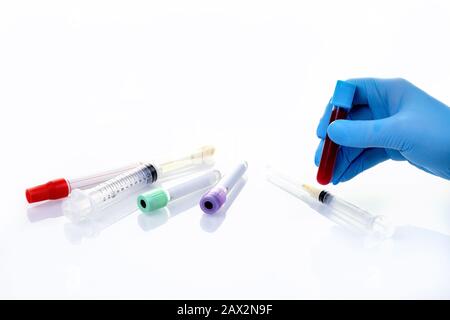 Il medico o l'infermiere che tiene la provetta con il sangue per il test di Coronavirus. 2019-nCoV sangue test Cina pericoloso virus. Foto Stock