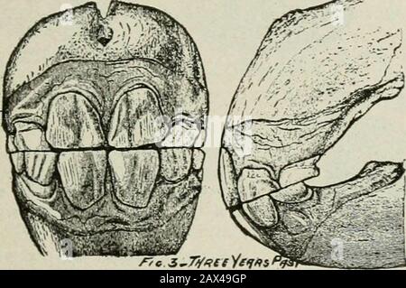 Agricoltura di successo: Un riferimento pronto su tutte le fasi dell'agricoltura per gli agricoltori degli Stati Uniti e del Canada. Fig. 1.- A un anno di età la mascella è stretta, il tè temporaneo piccolo e gli incisivi d'angolo arenot ancora in contatto. Fig. 2.-A due anni di età la mascella mostra una larghezza maggiore di un anno di età, e i theteeth sono tutti a contatto e mostrano una notevole usura. Foto Stock