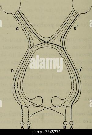 Transazioni . Trans./ 1883, vol. Ixvi, pag. 293, un articolo del titolo di un caso di asimmetria del cervello che presenta Peculiarità che si estendono Sulla Questione della connessione tra I Nervi ottici e alcune aree definite della corteccia Cerebrale. Cfr. Anche * Med.-Chir. Trans.,1884, vol. Ixvii, un articolo dell'autore intitolato Embolismo dell'arteria Cerebrale RightMiddle che produce emiplegia sinistra e Hemiana3sthesia.Absorption di una grande porzione dell'emisfero Destro. Morte sette anni dopo.* 282 MALATTIE DEL NERVO OTTICO. Ora^ lesioni dei tratti ottici, come già detto, provetliat th Foto Stock