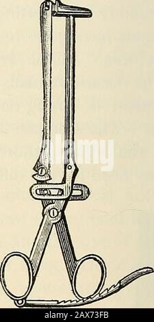 La patologia e il trattamento chirurgico dei tumori . Fig. 203.- pinze Intestinali (dopo Gussenbauer). Fig. 204.- pinze Intestinali (dopo Kiister). Parti che i diversi tipi di pinze o pinze. Il gauzeshould sterilizzato deve essere imballato intorno e sopra. I lati della parte da resecare,per assorbire tutto il fluido che potrebbe fuoriuscire durante l'operazione. Foto Stock