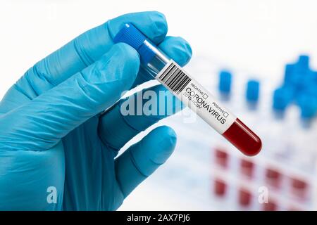 Campione di sangue di coronavirus in laboratorio. Nuovo virus umano 2019-nCoV a Wuhan, Cina. Foto Stock