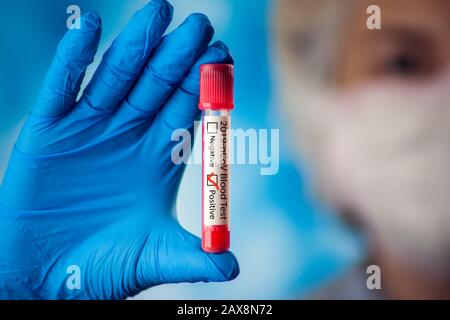 Medico femminile nella maschera medica e guanti blu che tengono la provetta con il sangue. Coronavirus, epidemia e concetto di assistenza sanitaria Foto Stock
