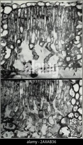 Rosetta di Pecan : la sua istologia, citologia e relazione con altre malattie clorotiche . Epidermide e Sezioni Di Foglie di Pecan. A. – Epidermide di un foglio illustrativo sano di pecan raccolto prima dell'alba e macchiato con iodin per showthe ritenzione di amido nelle cellule di guardia, x 540. B.- sezione Verticale di un foglio illustrativo pecan, che mostra un aggregato di cristallo di ossalato di calcio. X 420. C: Sezione Verticale di un giovane foglio di peci raccolto subito dopo la nascita dal germoglio, che mostra la differenziazione del tessuto palissade atThis fase iniziale di sviluppo. Ucciso in Carnoys fluido; Flemings tripla macchia utilizzata. X 540.D. Foto Stock