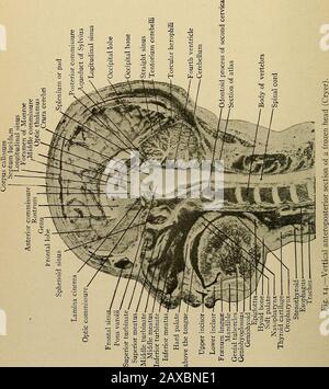 Anatomia applicata e chirurgia orale per gli studenti dentari. Ambra in una protesi dentaria superiore artificiale, cioè quando l'aria è esaurita dall'azione della lingua si crea vuoto apartiale quando la lingua è rilassata, dall'azione di cui il peso della mascella inferiore, con la lingua, È superato in una certa misura (Cryer) (Fig. 14). I muscoli della lingua sono divisi in due gruppi, il gruppo estrinseco e il gruppo intrinseco. I muscoli estrinseci della lingua sono: L'ioglosso, il genioioglosso e lo stillosso. Il palmato-glosso è anche attaccato alla lingua, ma il vvillo è des-ascrited wi Foto Stock