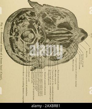 Anatomia applicata e chirurgia orale per gli studenti dentari . e, è la fossa palatina anteriore, che contiene quattro aperture, due delle quali sono la foramina di Scarpa, situata anteroposteriormente, e che trasmettono nervi di tenasopalatina, e due situate lateralmente, la teforamina di Stenson, che trasmettono le paleNinive anteriori. Nella sutura tra la mascella e l'osso del palato si trovano i palatinecani posteriori ed accessori, per la trasmissione dei palatinenerves posteriori e dei vasi. I fossati nasali I fossati nasali, in numero di due, sono situati uno su entrambi i lati della linea mediana della faccia, sepa Foto Stock