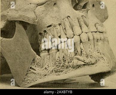 Anatomia applicata e chirurgia orale per gli studenti dentari . teriorlyis la fossa submascellare, che contiene la submaxillarygland, mentre sopra di essa, di fronte, è la fossa sublinguale, per la sistemazione della ghiandola sublinguale. Sulla superficie interna, sulla linea ediana, si trovano i quattro genialtubercoli, la coppia superiore per l'attacco dei muscoli geniiodioglossus, e la coppia inferiore per i muscoli genioiodioidi; sotto i tubercoli geniali si trova la fossa digastrica, per l'attacco del muscolo digastricmuscle. Proprio di fronte all'angolo della mandibola, sul bordo inferiore, si trova la tacca facciale, attraverso la quale pa Foto Stock
