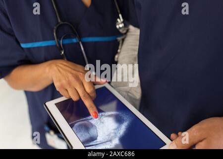 Primo piano medici che esaminano i raggi X digitali su tablet digitali in ospedale Foto Stock