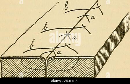 Midwifery pratico; manuale di trattamento re di iodio, o, in casi estremi, con una solu-zione diluita di persolfato di ferro (soluzione di Moncoels). CHIRURGIA OSTETRICA. 201 la cavità addominale deve essere pulita con spugne in camicia per spon{?e-holders e fatta passare al fondo di Douglassfossosa, o mediante iniezione di un gallone o più di acqua calda boiledwater. La ferita uterina deve essere chiusa da suture sieroserose interrotte intermuscolari e superficiali di seta asettica o di intestino gatto (Fig. 50). Il i^eritoneum dovrebbe essere disegnato leggermente più a riccio su entrambi i lati, suture profonde di medie dimensioni Foto Stock