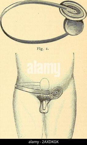 Therapeutisches Lexikon : für praktische Ärzte . Fig. 3.. Foto Stock