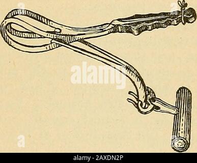 Ostetricia pratica; manuale di trattamento odel (Fig. 24) è uno dei più aggraziati e conveniente ancora escogitato. Uno dei più noti strumenti americani, Lusks modifica di Tarnier, al contrario retainsThe curva extra; ma anche se questo strumento è indubbiamente con-veniente per l'uso in alcuni casi difficili elevati, la sua maggiore difficoltà di applicazione lo rende meno prezioso per l'uso generale. Simpsonsaxis-trazione forcipe è semplicemente un po 'lungo e pesante Simp-son forcipe, a cui assi-trazione aste sono stati fissati da ascrew e dado. La sua unica obiezione è che è difficile c Foto Stock