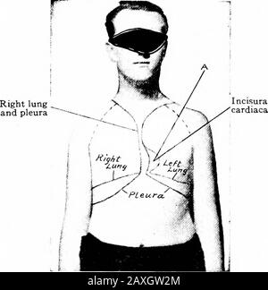 Un manuale di anatomia . i a i pollice (i a 2,5 cm.) sopra la clavicola sopra l'estremità sternale della prima nervatura, disegnare una linea al topass della linea midsternale sotto l'articolazione sternoclavicolare. Sulla destra sidedemodificare questa linea fino al livello della sesta giunc condrosternale, poi obliquamente verso l'esterno fino alla decima costola, o interspazio sulla linea emidascellare e poi orizzontalmente fino ad un punto compreso tra la colonna vertebrale della dodicesima vertebra toracica e la processazione trasversale della prima vertebra lombare. Da questo punto si porta una linea verticale fino al bordo superiore della terza vertebra toracica AN Foto Stock