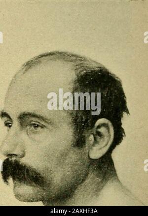 Malattie del cuore e del sistema arterioso : concepito per essere una presentazione pratica del soggetto per l'uso di studenti e professionisti della medicina . Foto Stock