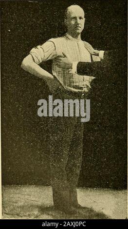 Malattie del cuore e del sistema arterioso : concepito per essere una presentazione pratica del soggetto per l'uso di studenti e professionisti della medicina . Fig. 91.. Foto Stock