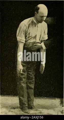 Malattie del cuore e del sistema arterioso : concepito per essere una presentazione pratica del soggetto per l'uso di studenti e professionisti della medicina . Fig. 91. Foto Stock