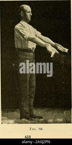 Malattie del cuore e del sistema arterioso : concepito per essere una presentazione pratica del soggetto per l'uso di studenti e professionisti della medicina . Fig. 87.. Foto Stock