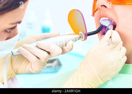 Ragazza bambino al medico. Il dentista posiziona un riempimento su un dente con la lampada di polimerizzazione dentale in cavità orale. Su sfondo clinico Foto Stock