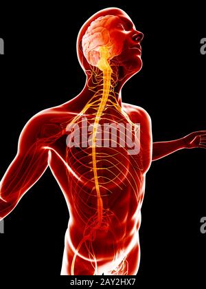 illustrazione concettuale - sistema nervoso infiammato Foto Stock