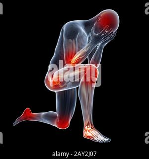 illustrazione medica che mostra infiammato Foto Stock