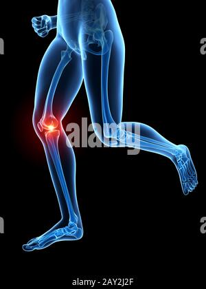 illustrazione 3d rappresentata - ginocchio doloroso joggers Foto Stock