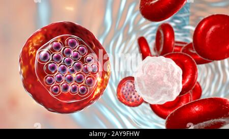 Plasmodium falciparum all'interno dei globuli rossi, illustrazione Foto Stock