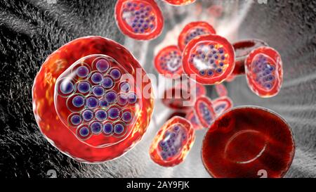 Plasmodium falciparum all'interno dei globuli rossi, illustrazione Foto Stock
