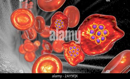 Plasmodium ovale all'interno dei globuli rossi, illustrazione Foto Stock