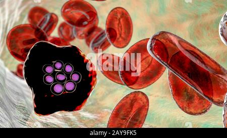 Plasmodium ovale all'interno dei globuli rossi, illustrazione Foto Stock