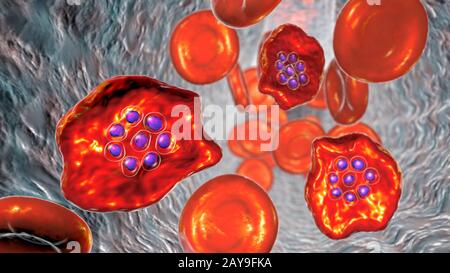 Plasmodium ovale all'interno dei globuli rossi, illustrazione Foto Stock