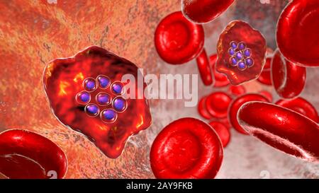 Plasmodium ovale all'interno dei globuli rossi, illustrazione Foto Stock