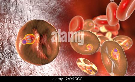 Plasmodium malariae all'interno dei globuli rossi, illustrazione Foto Stock