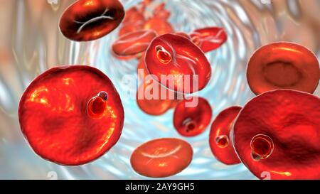 Plasmodium malariae all'interno dei globuli rossi, illustrazione Foto Stock