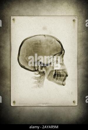 Cranio a raggi X su sfondo di carta vintage Foto Stock