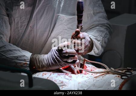 Chirurgia sul torace, sostituzione cardiaca, cardiologia, chirurgo fissa morsetto e allungamento per le costole Foto Stock