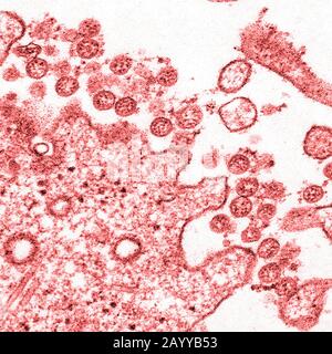 Immagine microscopica elettronica di trasmissione di un isolato dal primo caso USA di COVID-19, precedentemente noto come 2019-nCoV. Le particelle virali extracellulari sferiche contengono sezioni trasversali attraverso il genoma virale, viste come punti rossi. Foto Stock