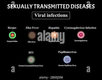 HIV, herpes, papillomavirus, AIDS, epatite, citomegalovirus, virus Zika. Serie di infezioni virali. Malattie sessualmente trasmissibili. Infografiche Illustrazione Vettoriale