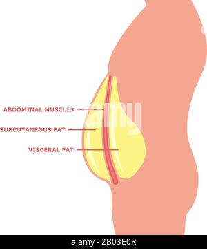 Grasso viscerale in un corpo maschio isolato su bianco. Un essere umano con una pancia grande e grasso viscerale sottocutaneo all'interno. Illustrazione del vettore con una descrizione. Illustrazione Vettoriale