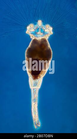 Colotheca rotifer (Collotheca spec.), interphako picture, x 200, Germania Foto Stock