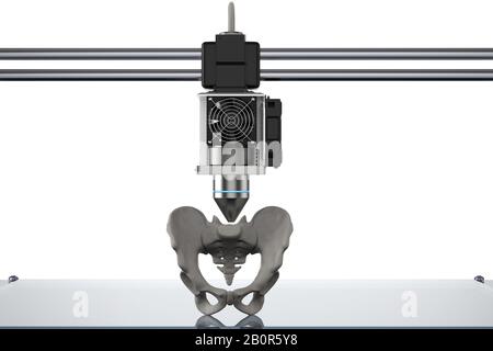 la stampante 3d di rendering 3d stampa l'osso protesico dell'anca Foto Stock