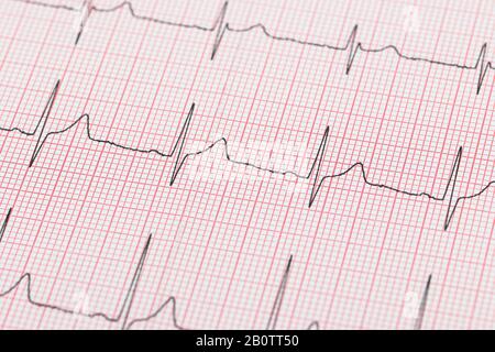 linea reale di un cardiogramma elettrico Foto Stock